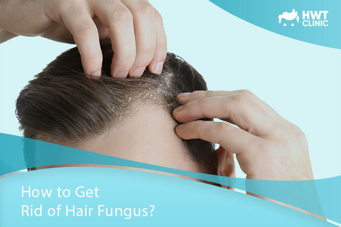 how-to-get-rid-of-hair-fungus-hwt-clinic-blog